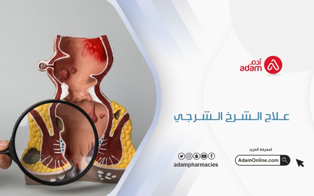 Anal fissure treatment